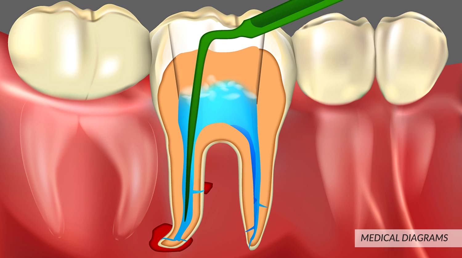 Digital illustration of Teeth Operate